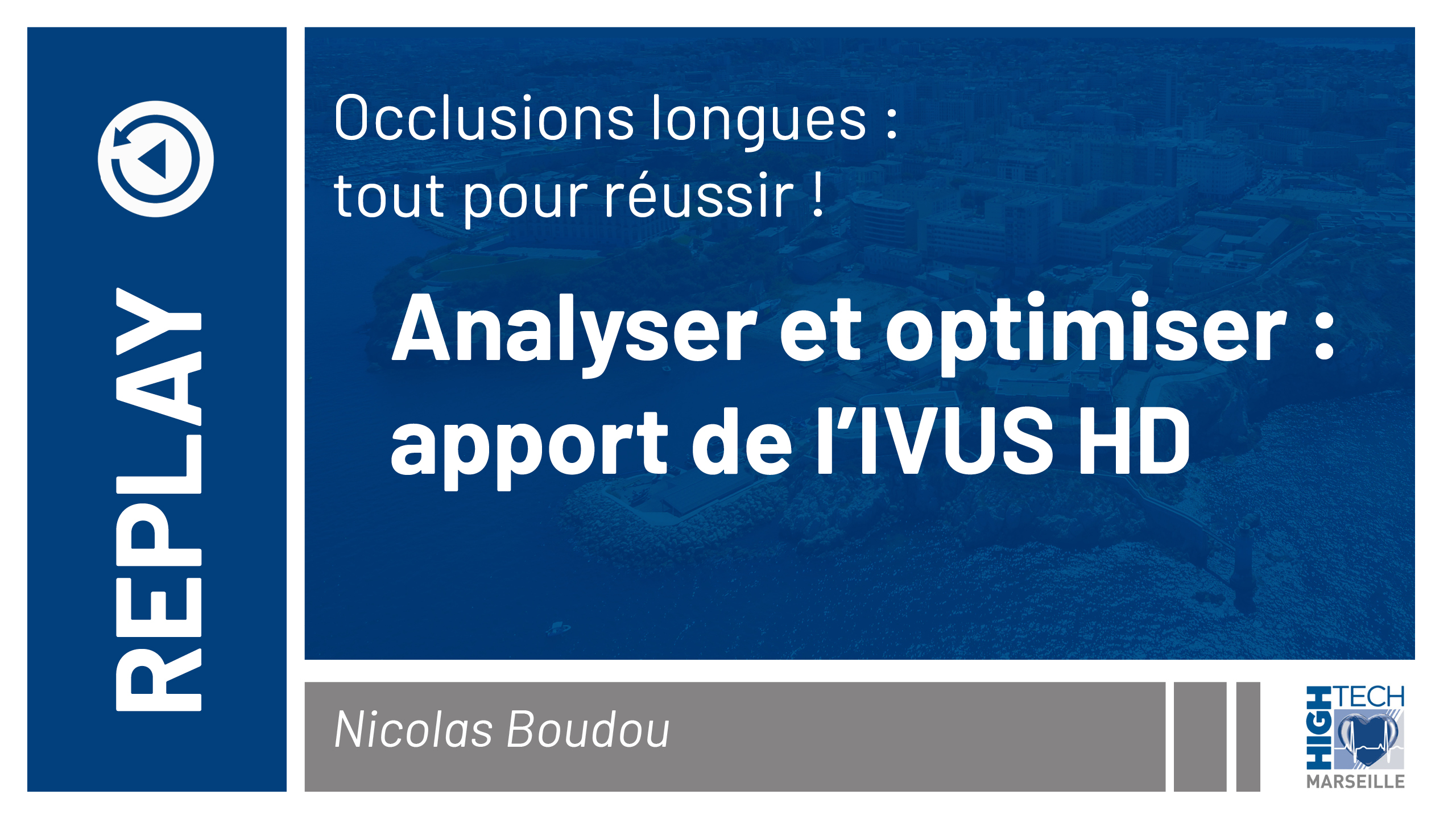 Analyser et optimiser : apport de l’IVUS HD – Nicolas Boudou