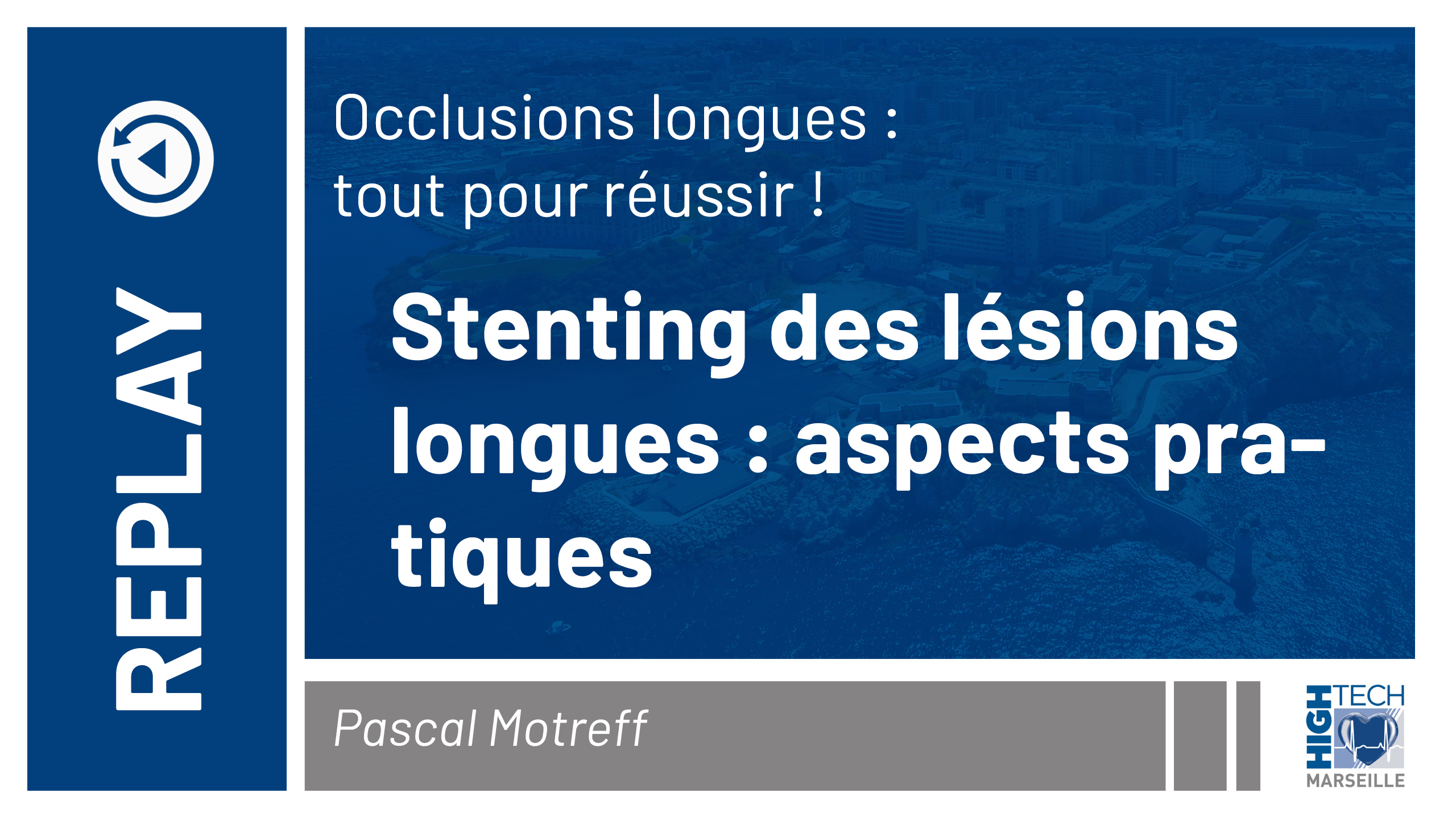 Stenting des lésions longues : aspects pratiques – Pascal Motreff