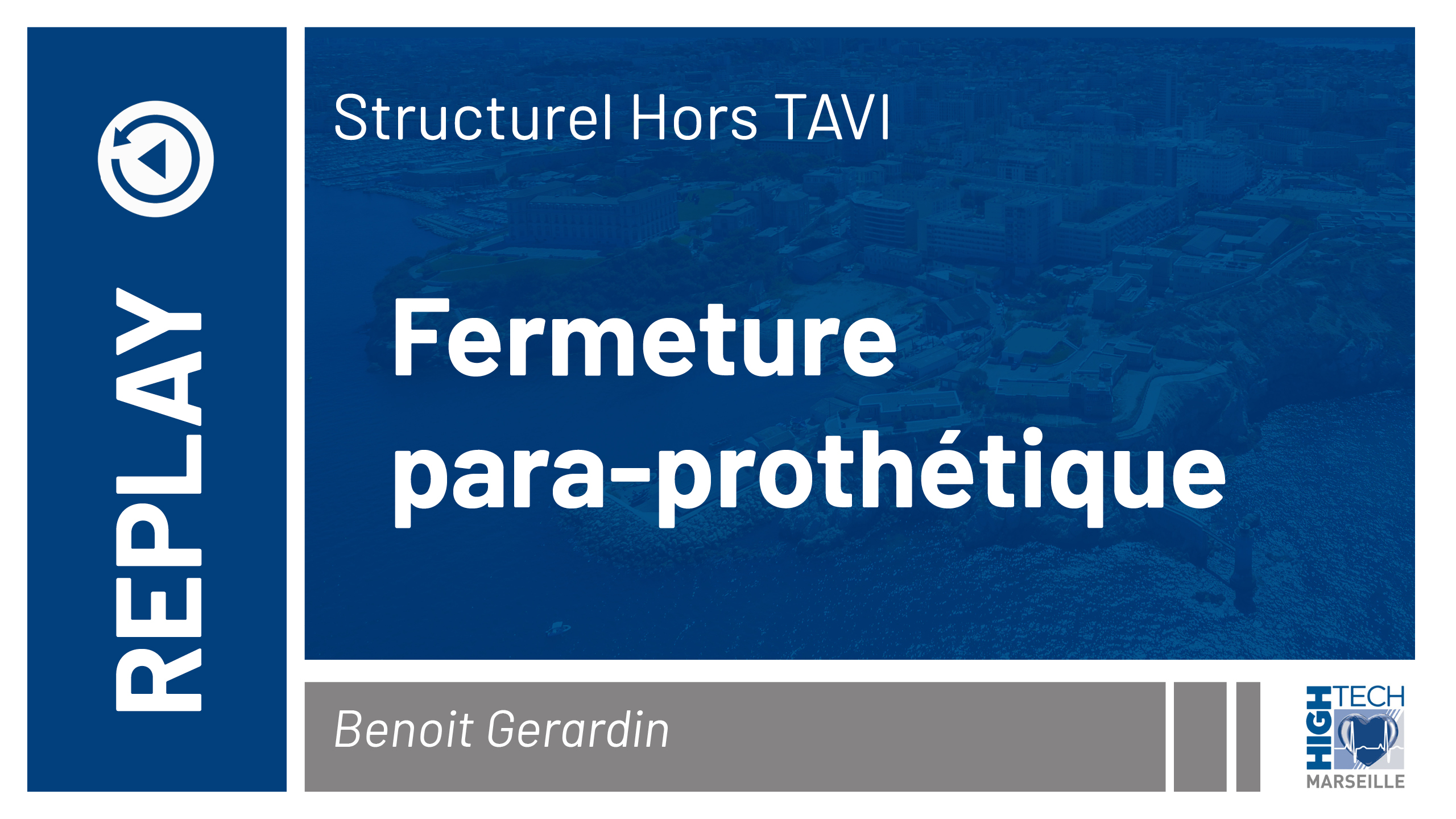 Fermeture para-prothétique – Benoit Gerardin
