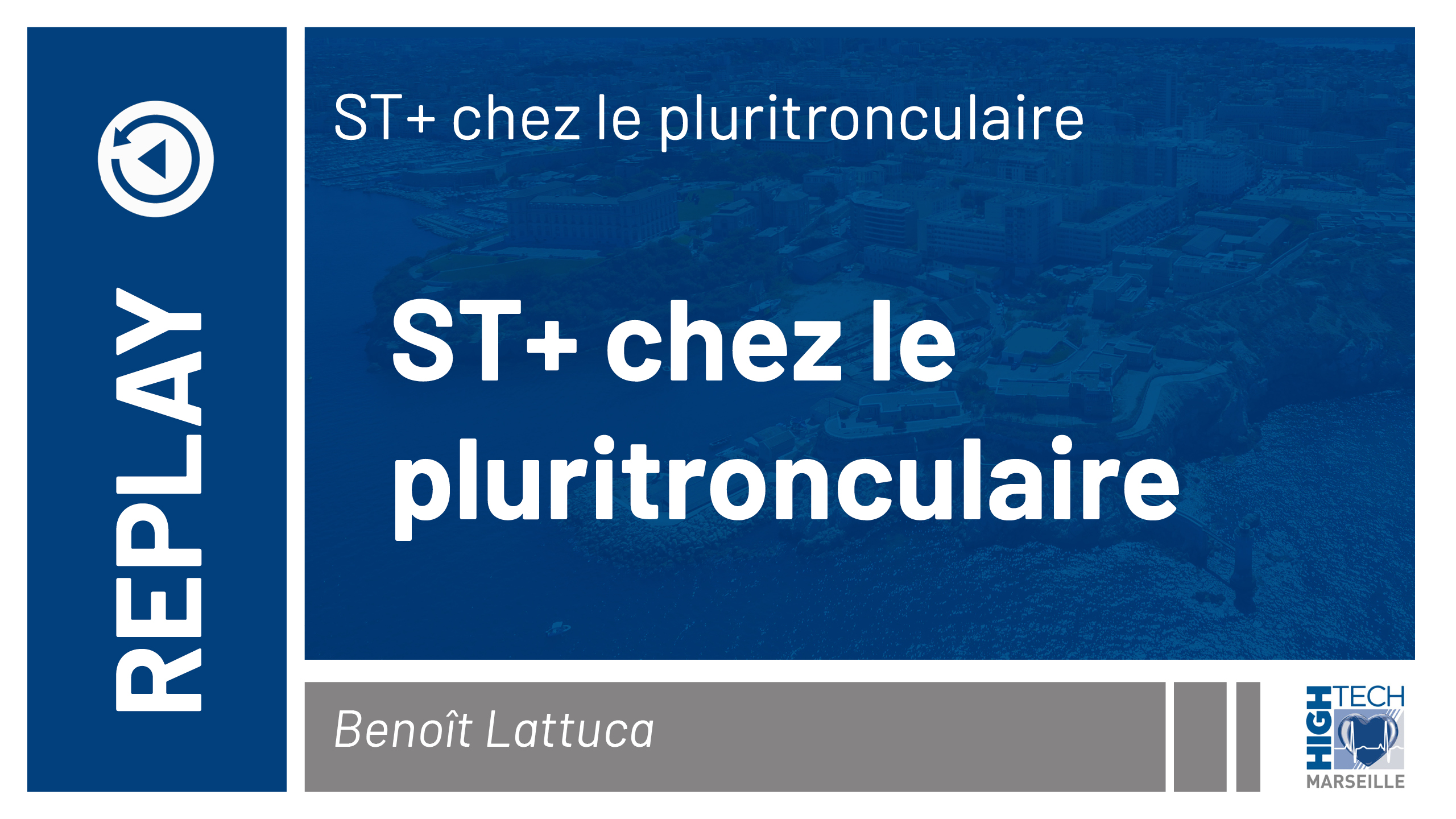 ST+ chez les pluritronculaires – Benoît Lattuca
