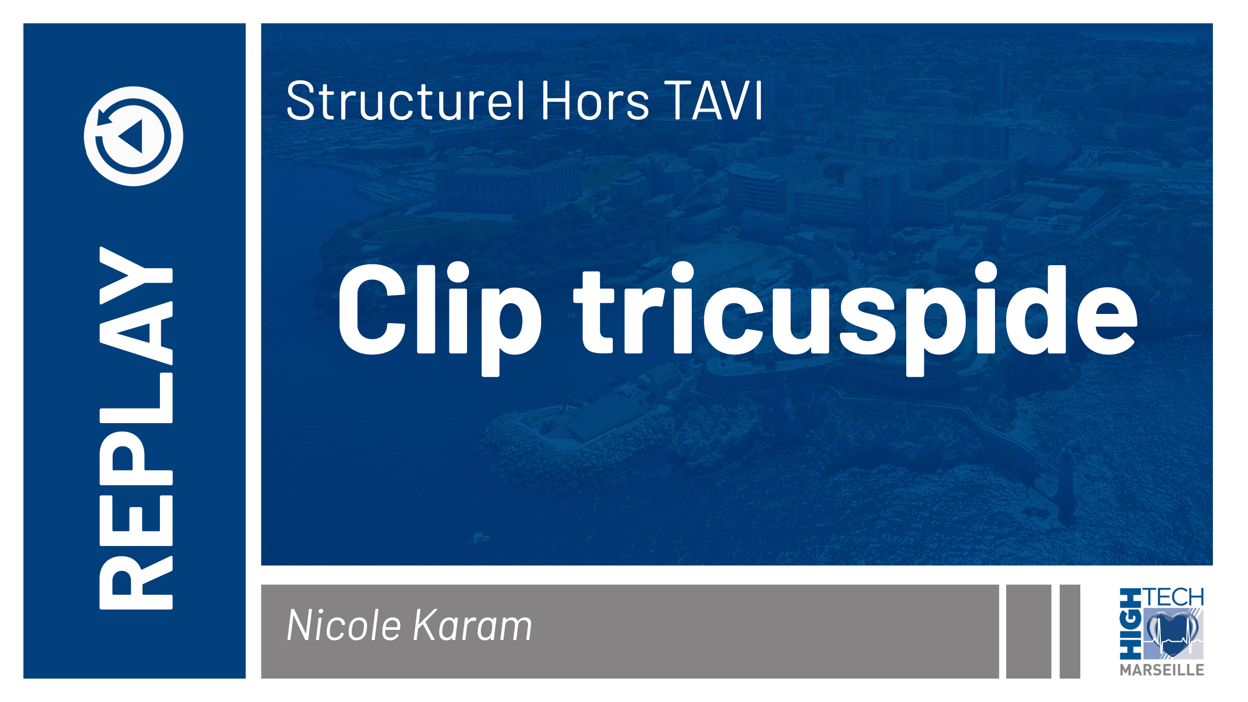 Clip tricuspide – Nicole Karam