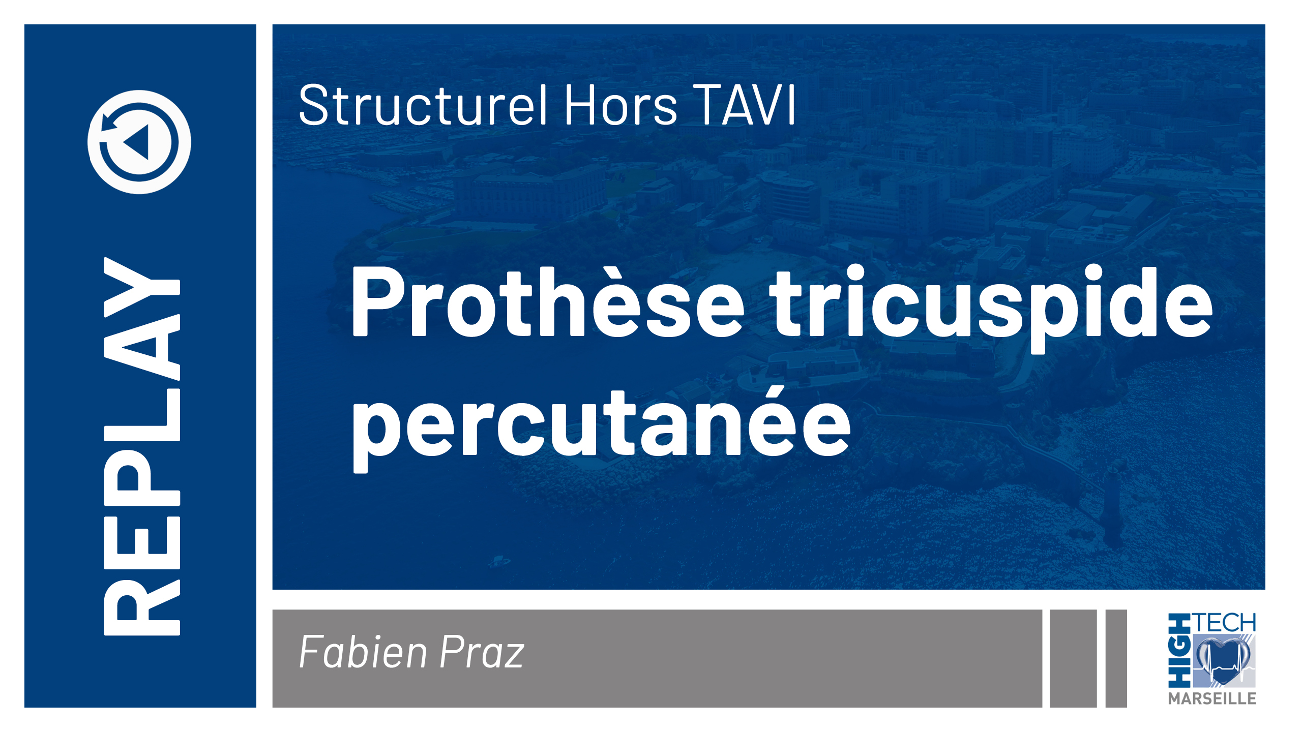 Prothèse tricuspide percutanée – Fabien Praz