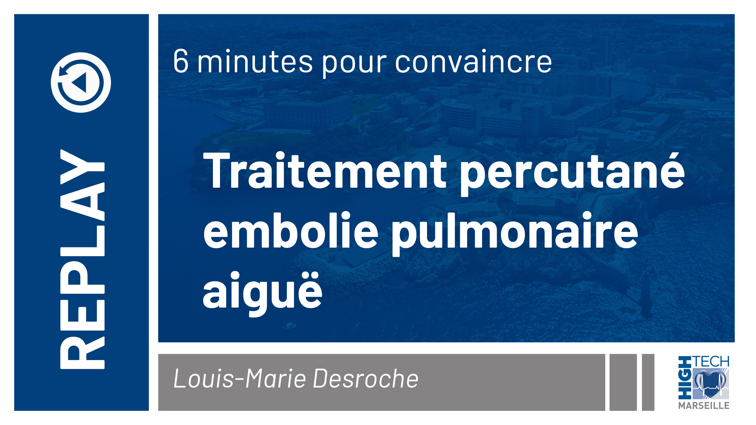 Traitement percutané embolie pulmonaire aiguë – Louis-Marie Desroche