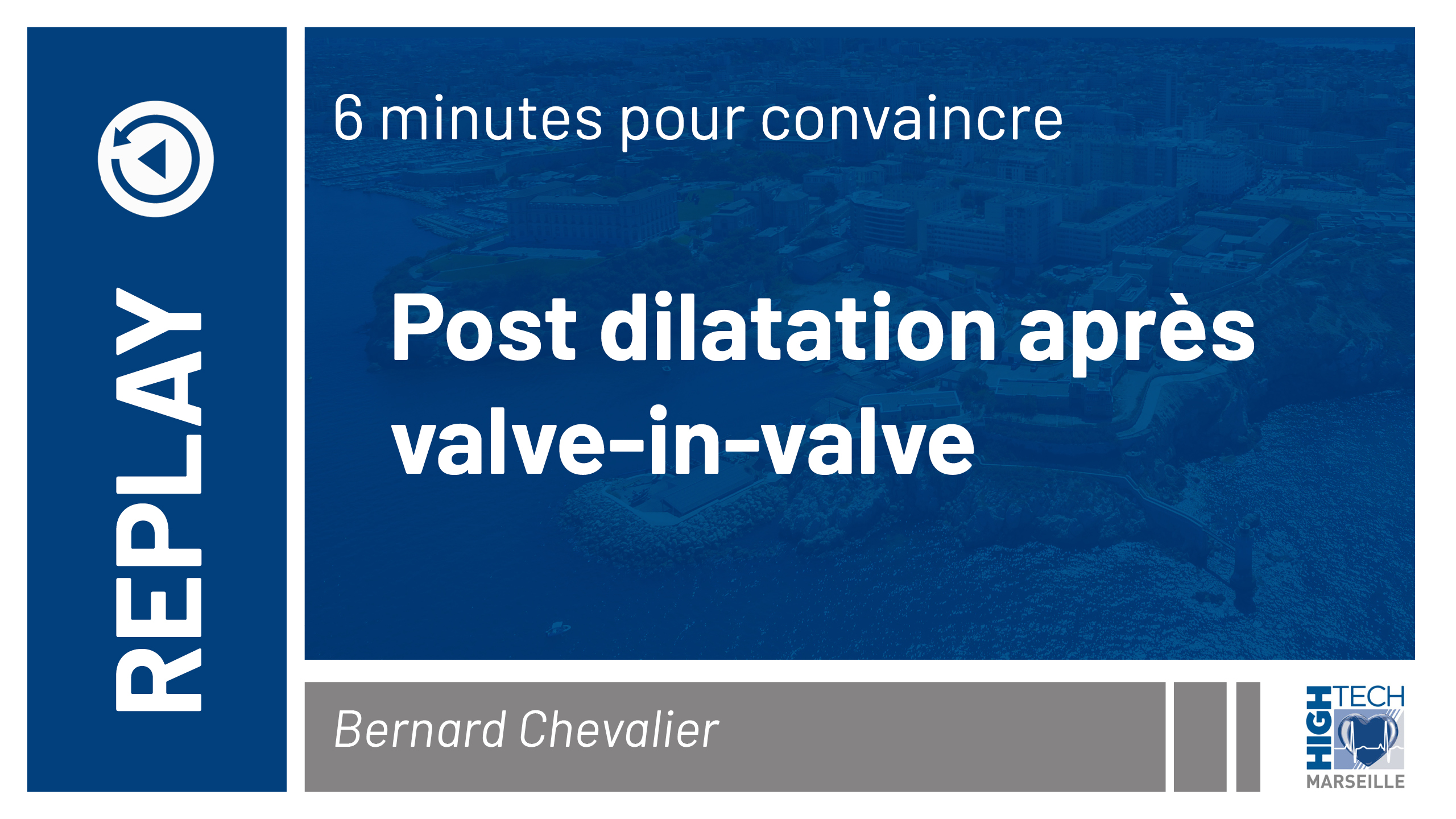 Post dilatation après valve in valve – Bernard Chevalier