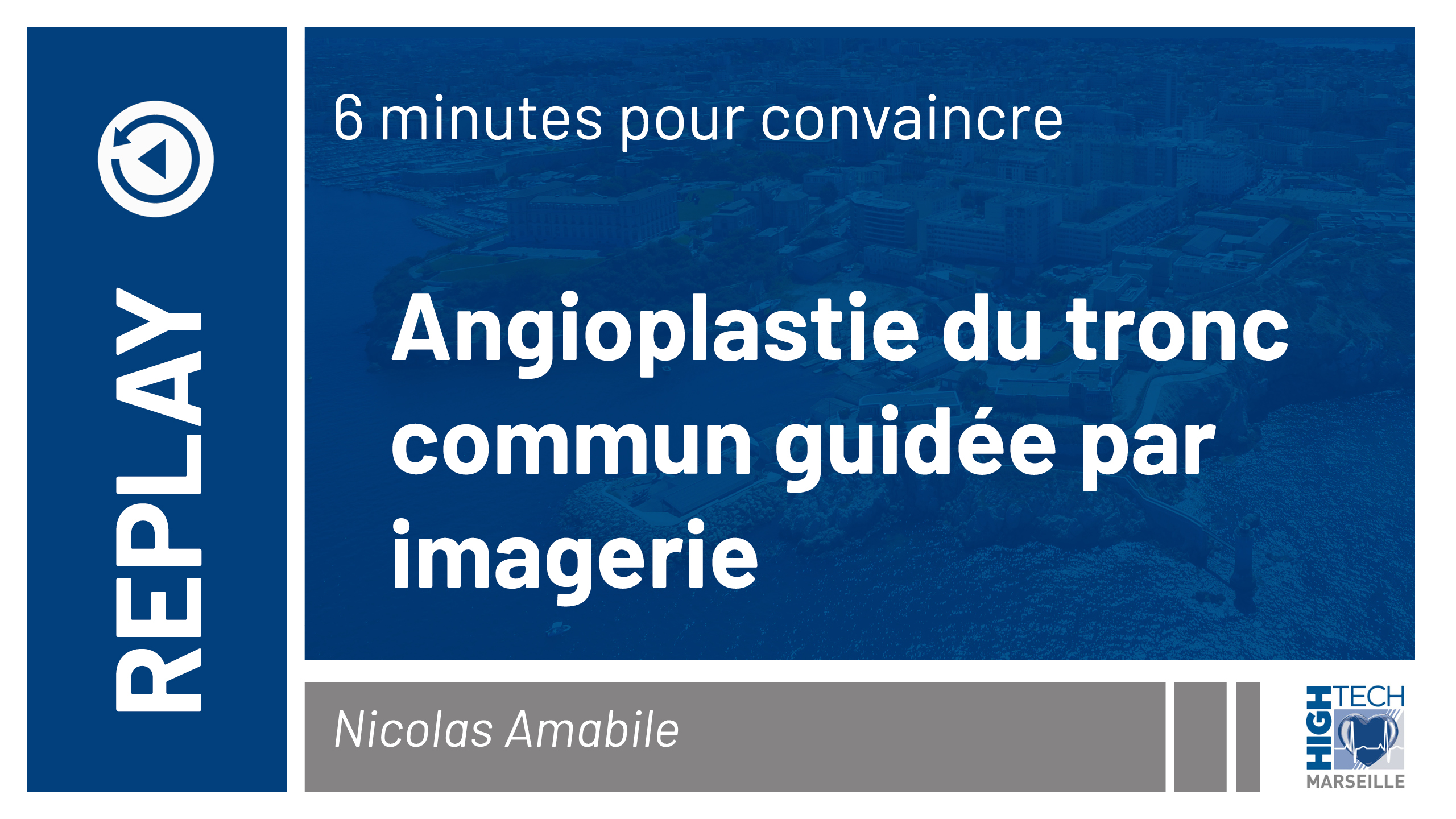 Angioplastie du tronc commun guidée par imagerie – Nicolas Amabile