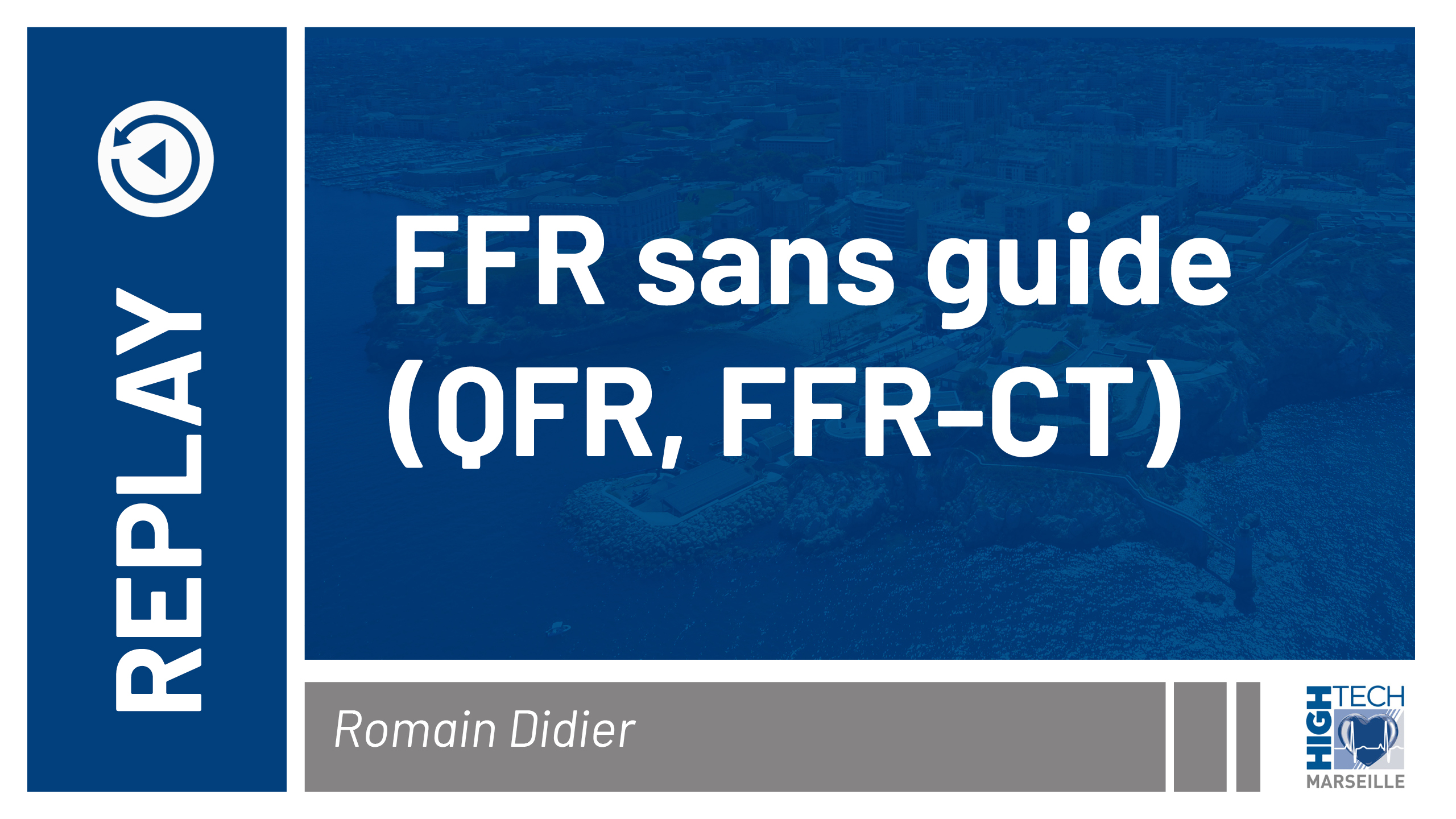 FFR sans guide – Romain Didier