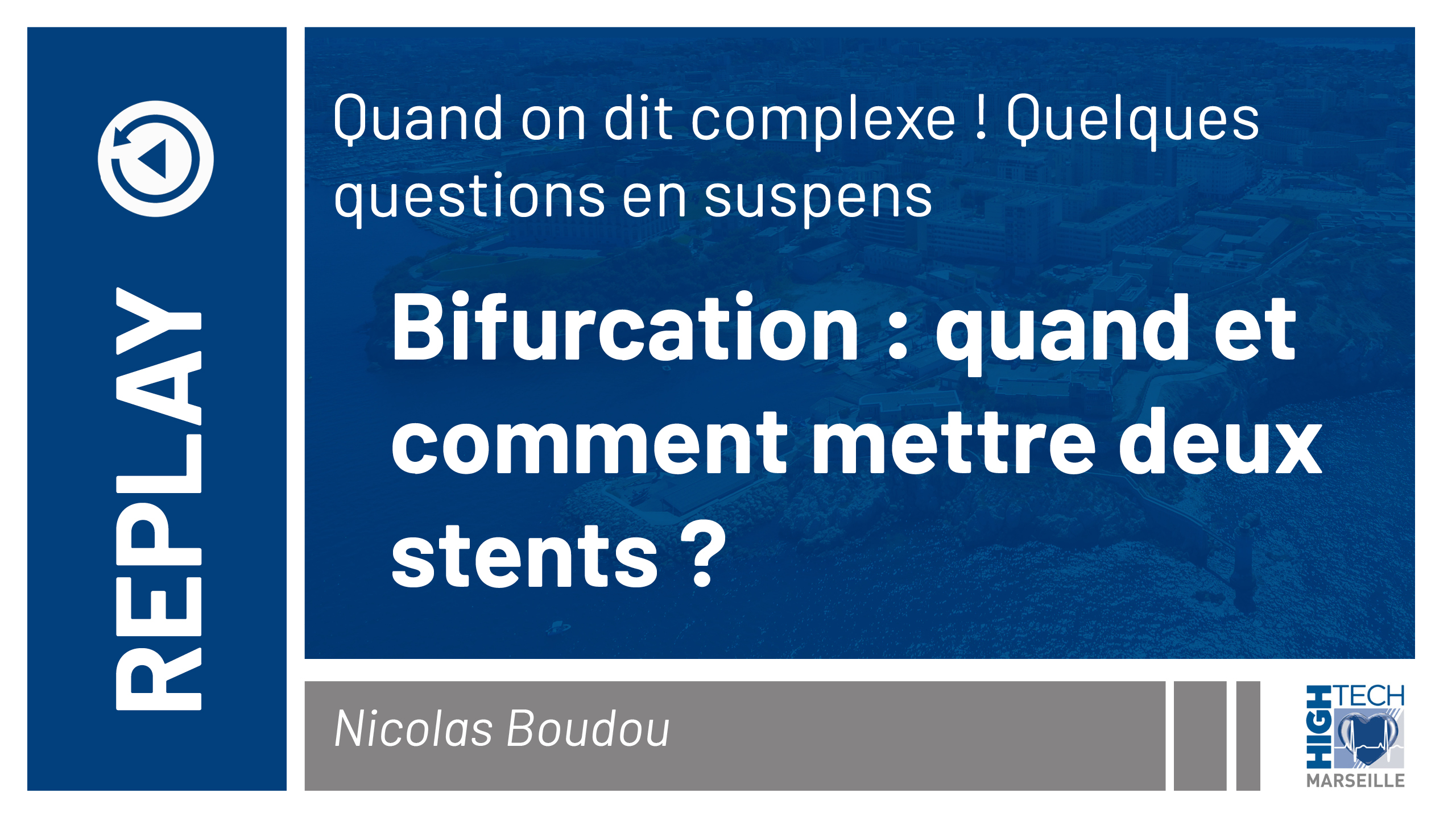 Bifurcation : quand et comment mettre deux stents ? Nicolas Boudou