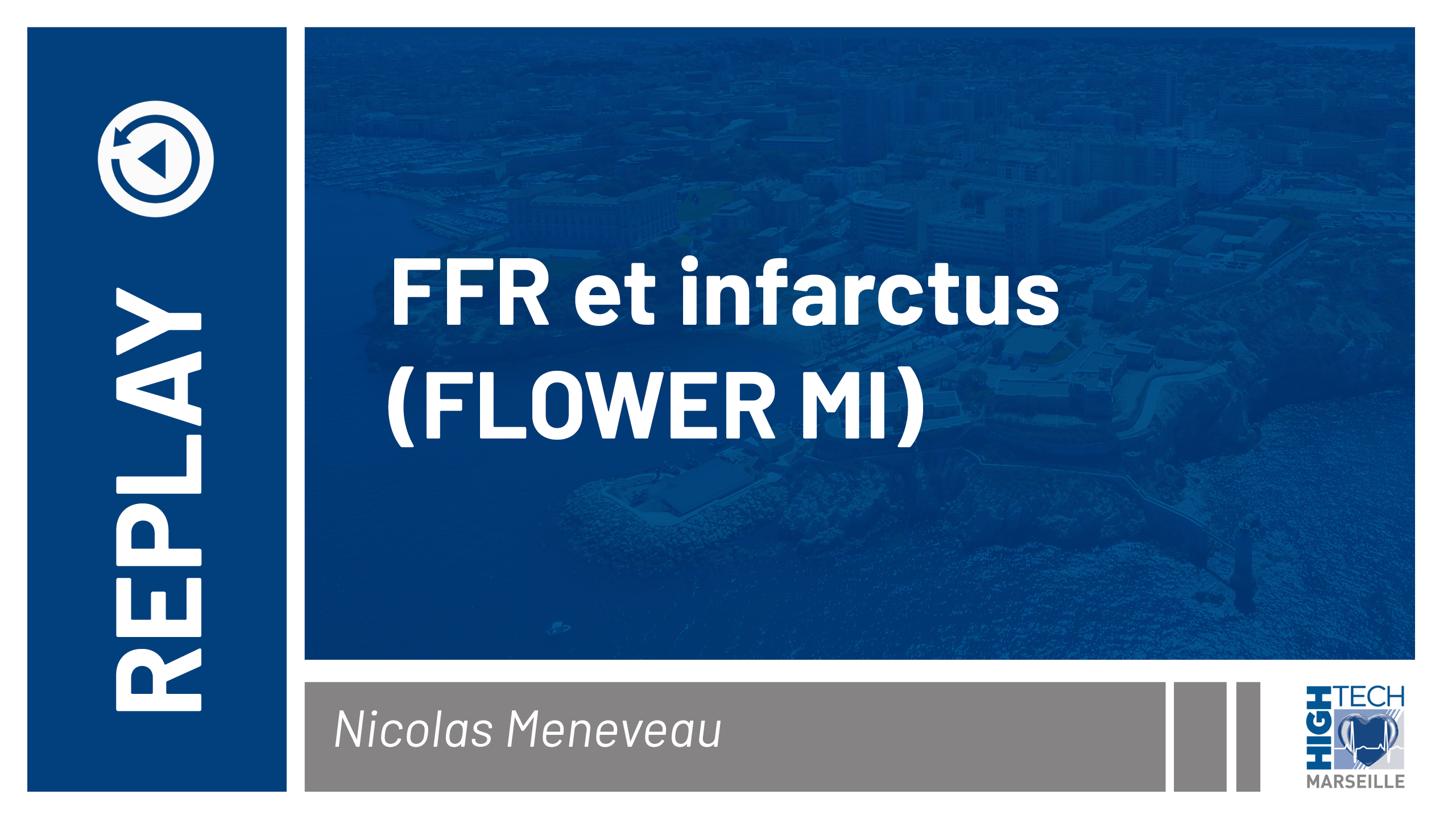 FFR et infarctus – Nicolas Meneveau