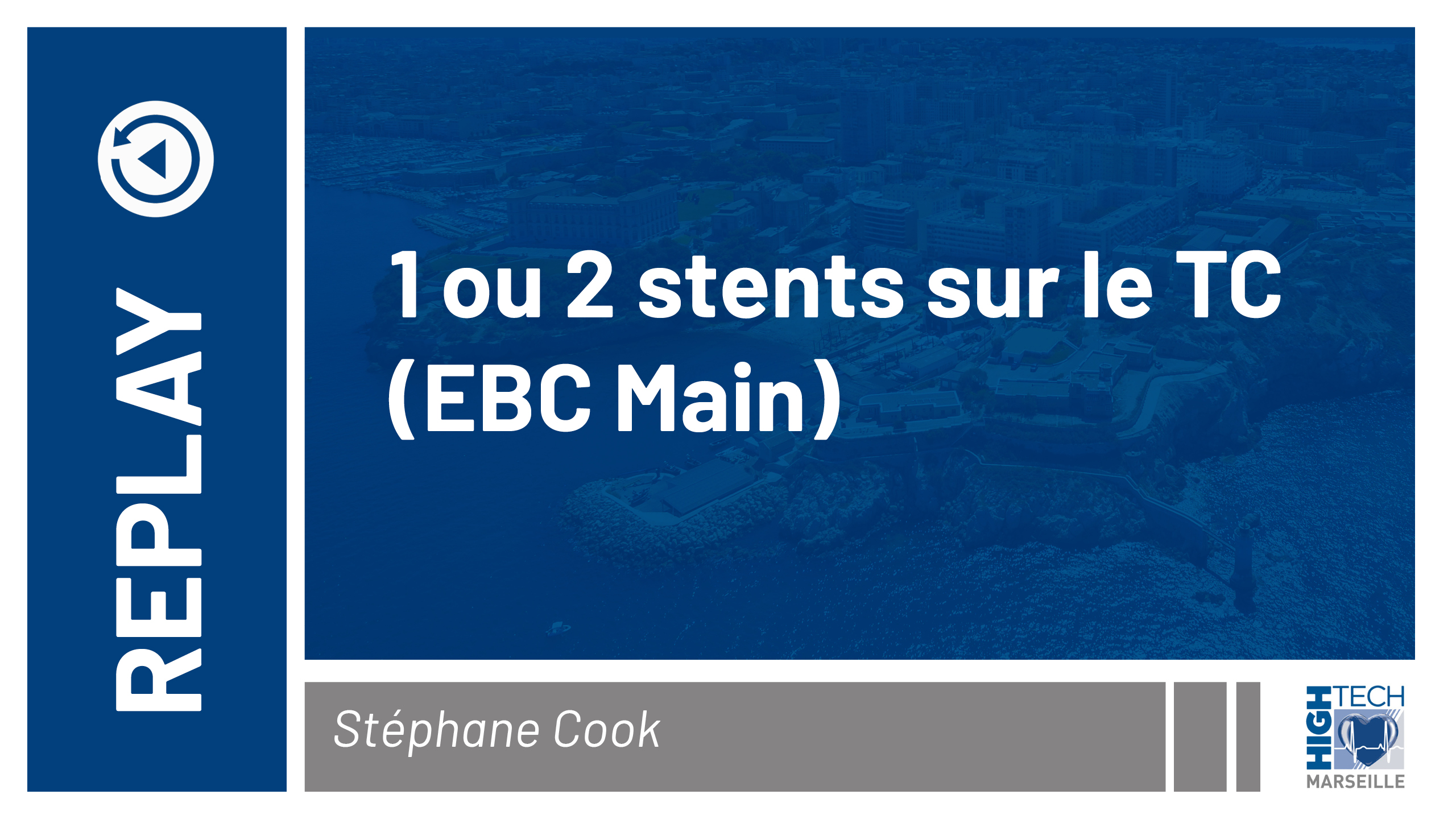 1 ou 2 stents sur le TC – Stéphane Cook