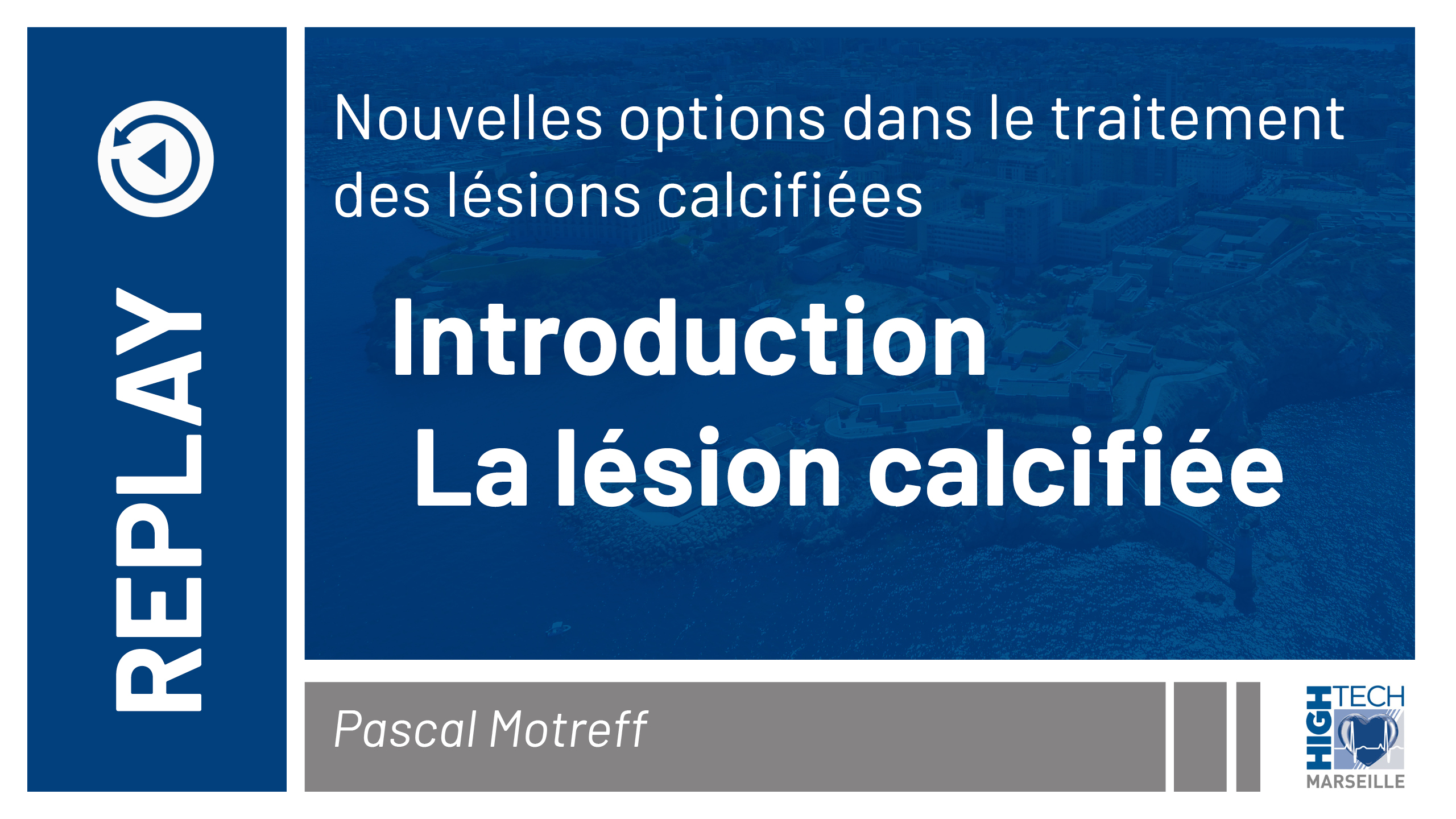 Introduction : La lésion calcifiée – Pascal Motreff
