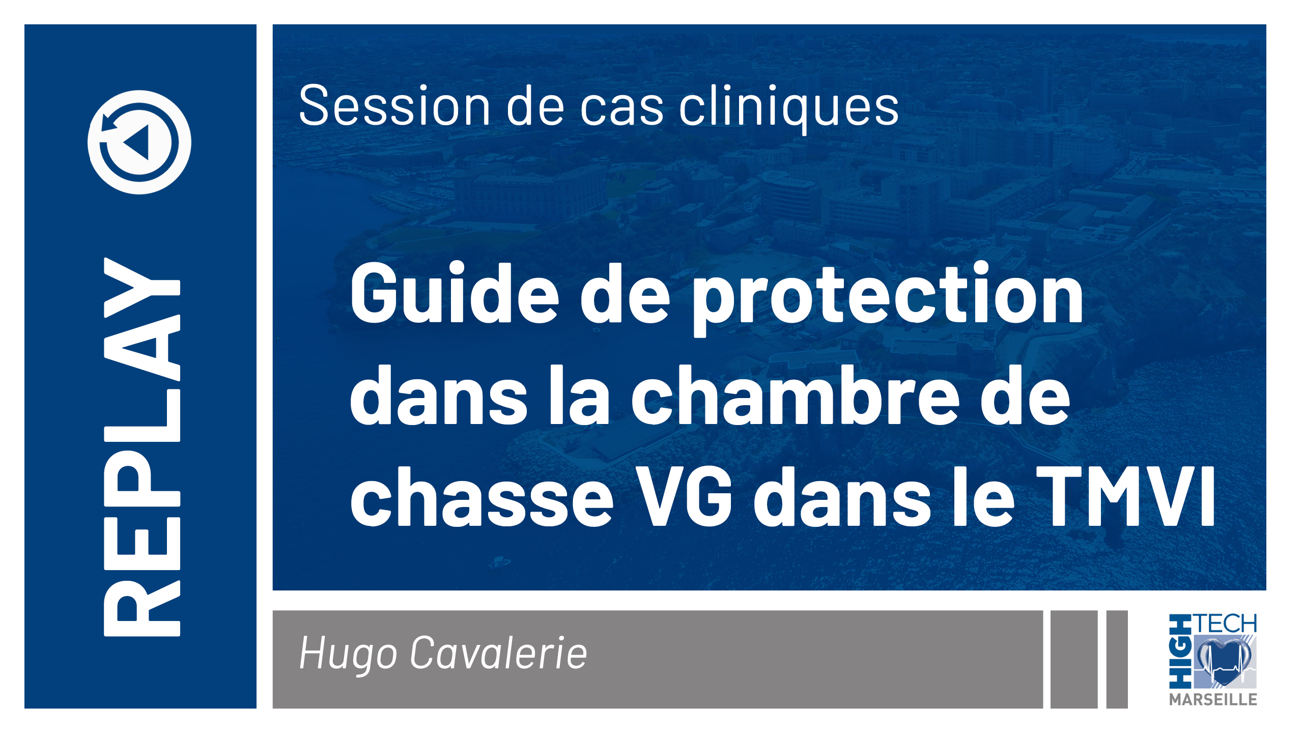 Guide de protection dans la chambre de chasse VG dans le TMVI – Hugo Cavalerie