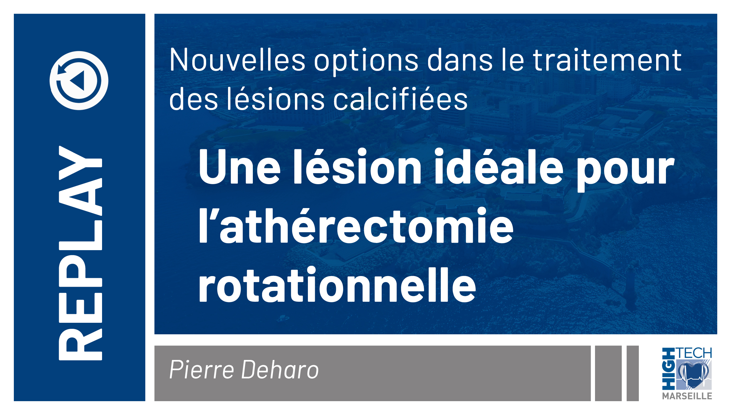 Une lésion idéale pour l’athérectomie rotationnelle – Pierre Deharo