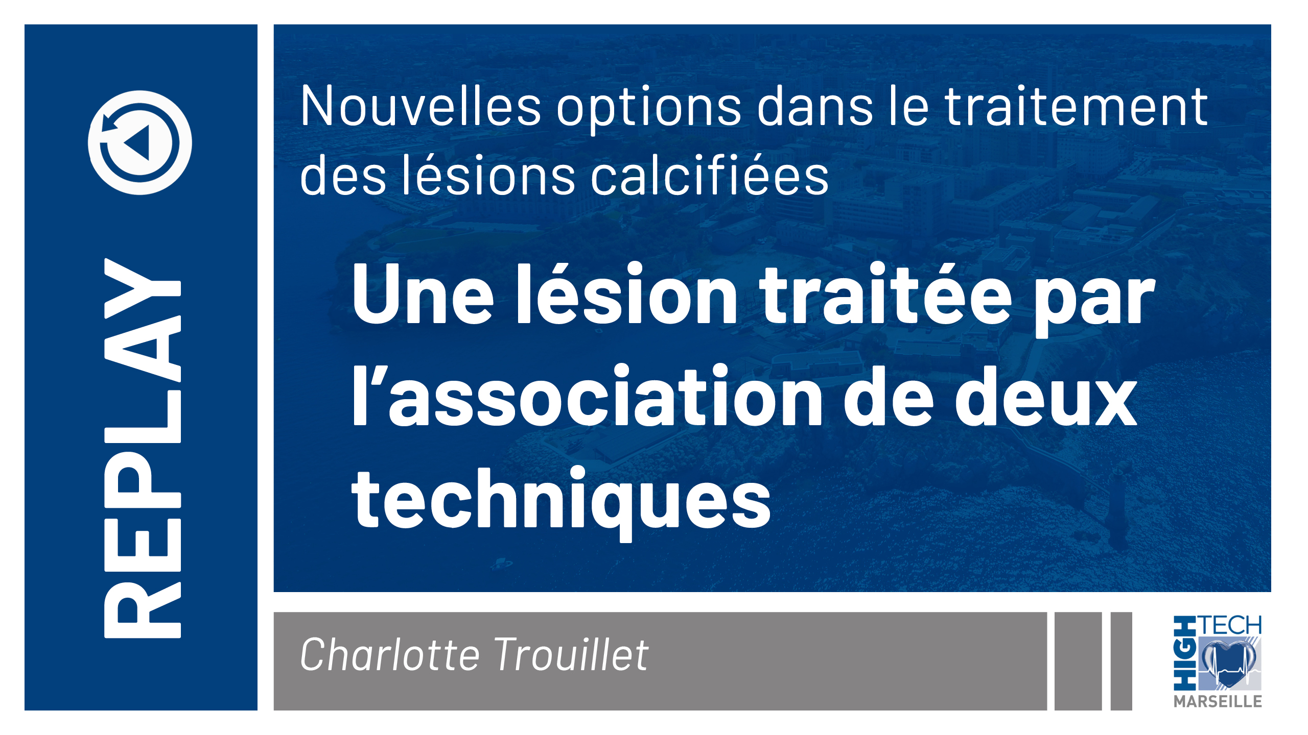 Une lésion traitée par l’association de deux techniques – Charlotte Trouillet