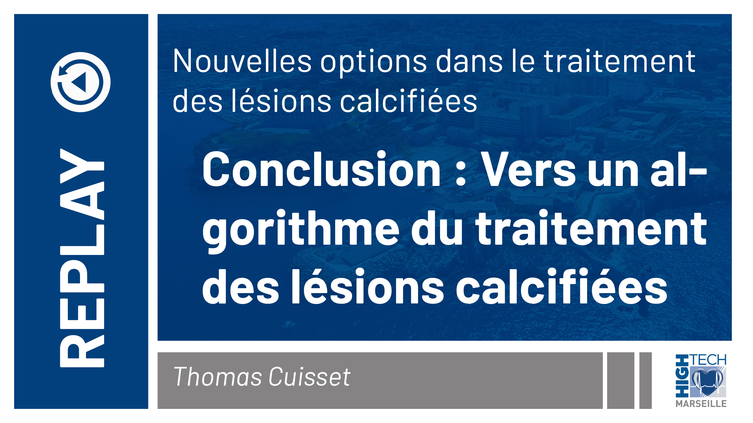 Conclusion : Vers un algorithme du traitement des lésions calcifiées – Thomas Cuisset