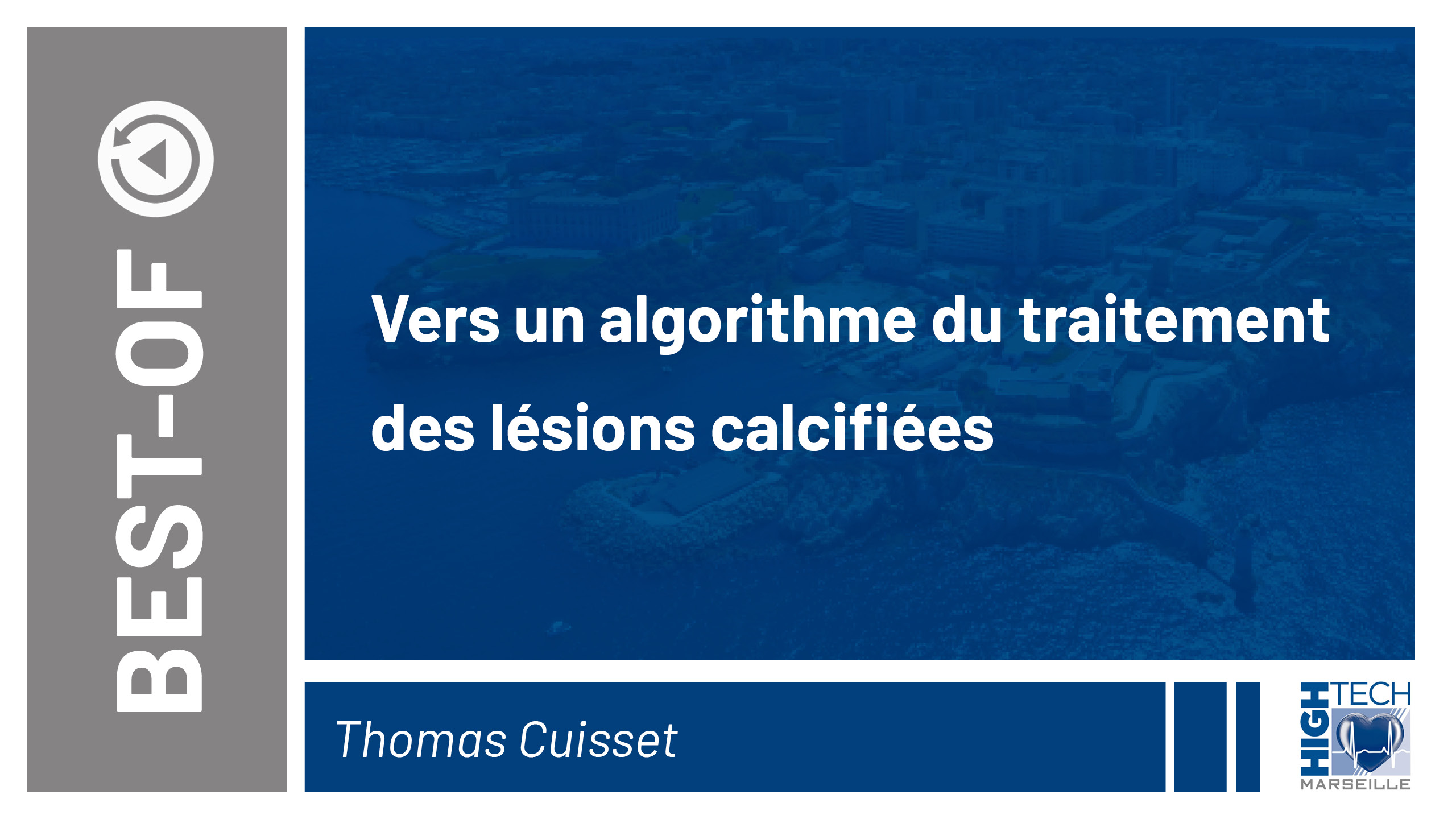 Vers un algorithme du traitement des lésions calcifiées – Thomas Cuisset