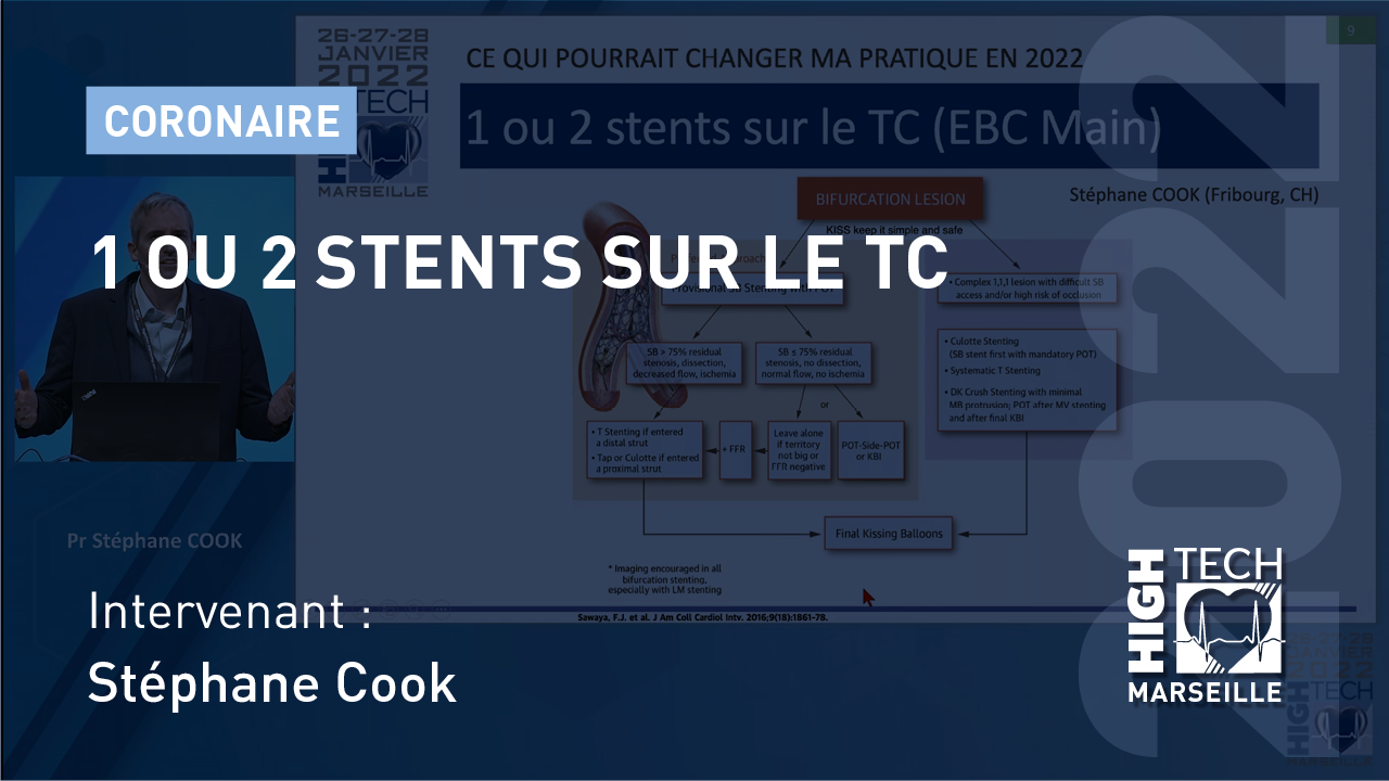 1 ou 2 stents sur le TC – Stéphane Cook