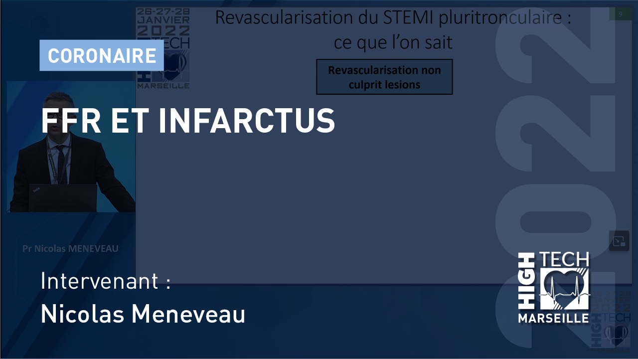 FFR et infarctus – Nicolas Meneveau