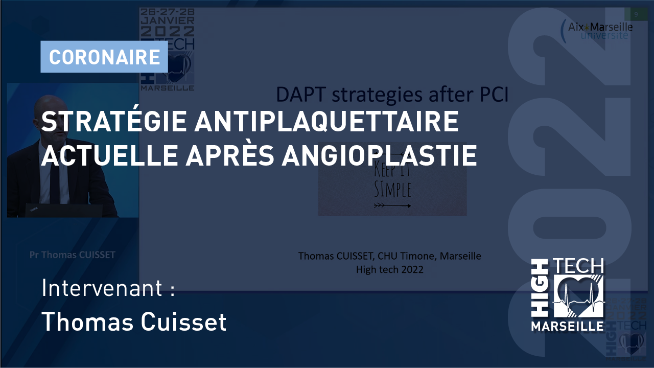 Stratégie antiplaquettaire actuelle après angioplastie – Thomas Cuisset