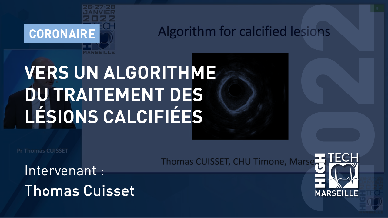 Vers un algorithme du traitement des lésions calcifiées – Thomas Cuisset