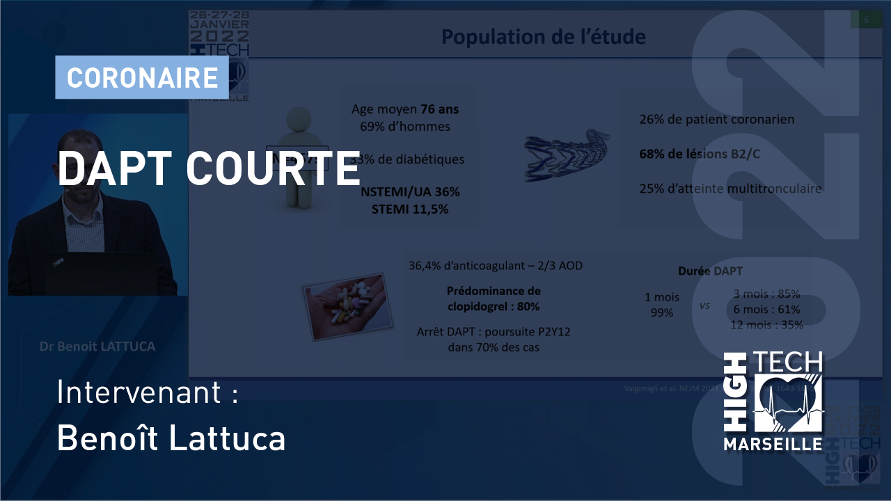 DAPT courte – Benoît Lattuca