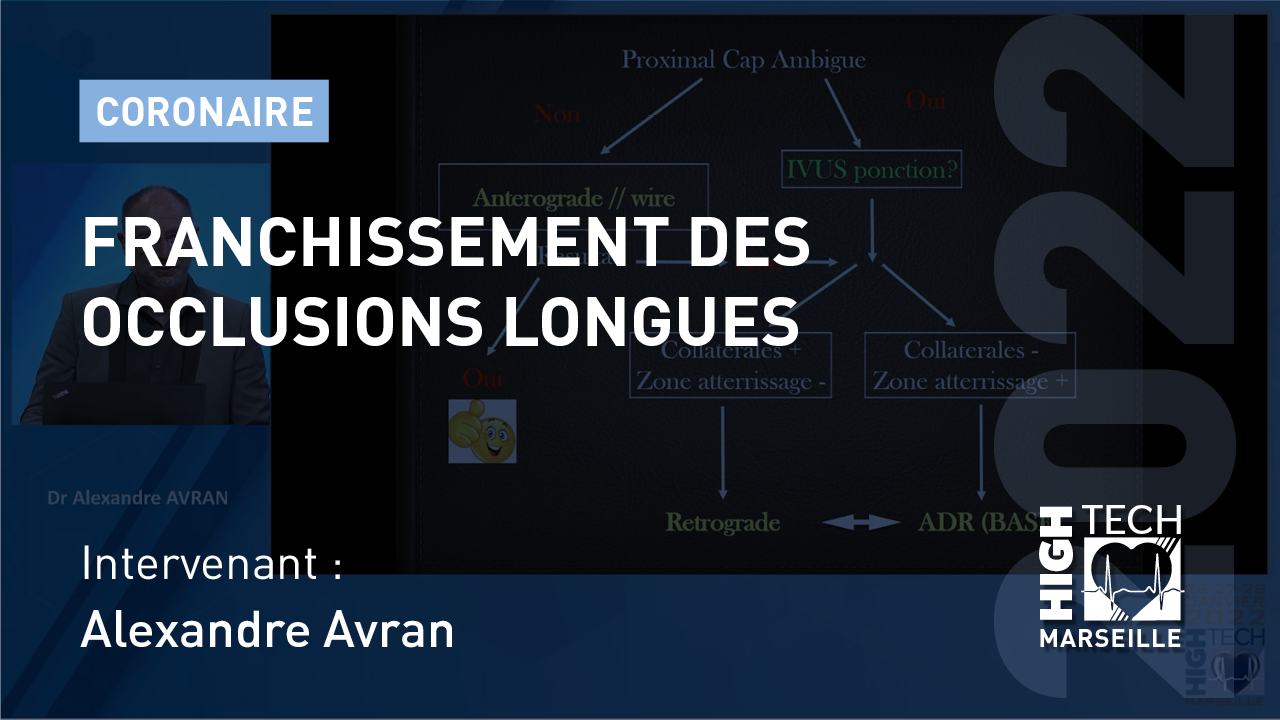 Franchissement des occlusions longues – Alexandre Avran