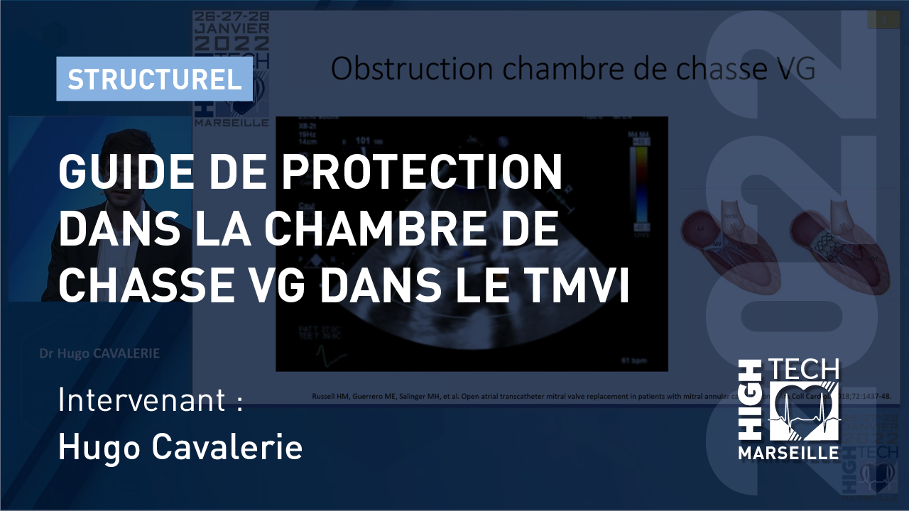 Guide de protection dans la chambre de chasse VG dans le TMVI – Hugo Cavalerie