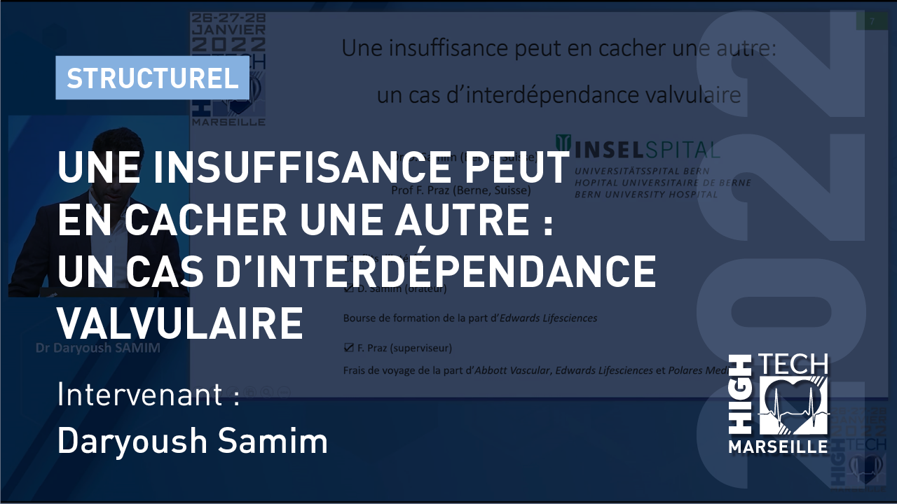 Une insuffisance peut en cacher une autre : un cas d’interdépendance valvulaire – Daryoush Samim