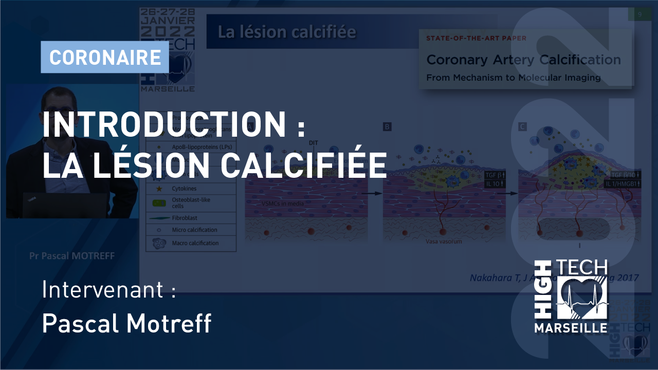 Introduction : La lésion calcifiée – Pascal Motreff