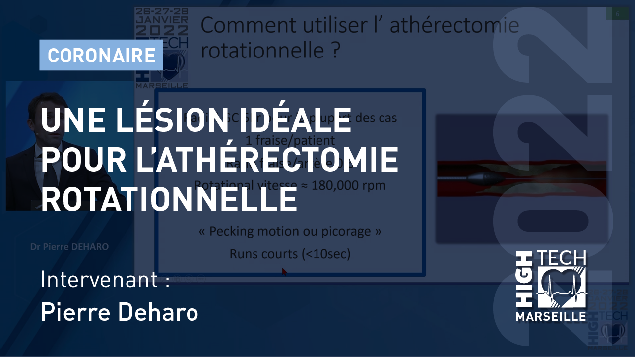 Une lésion idéale pour l’athérectomie rotationnelle – Pierre Deharo