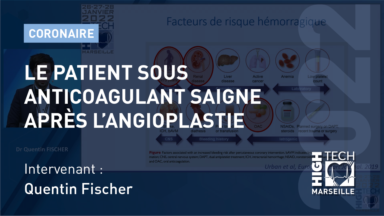 Le patient sous anticoagulant saigne après l’angioplastie – Quentin Fischer