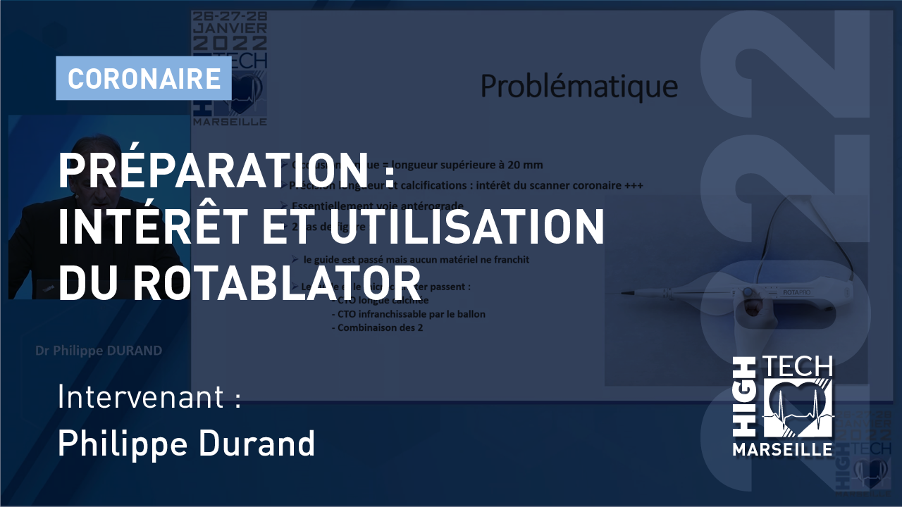 Préparation : intérêt et utilisation du Rotablator – Philippe Durand