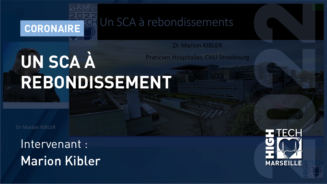 Un SCA à rebondissement – Marion Kibler