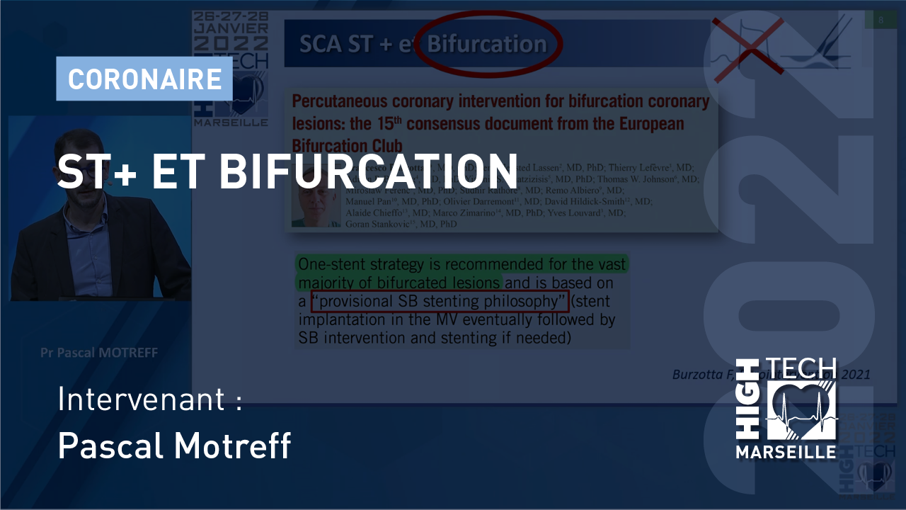 ST+ et bifurcation – Pascal Motreff