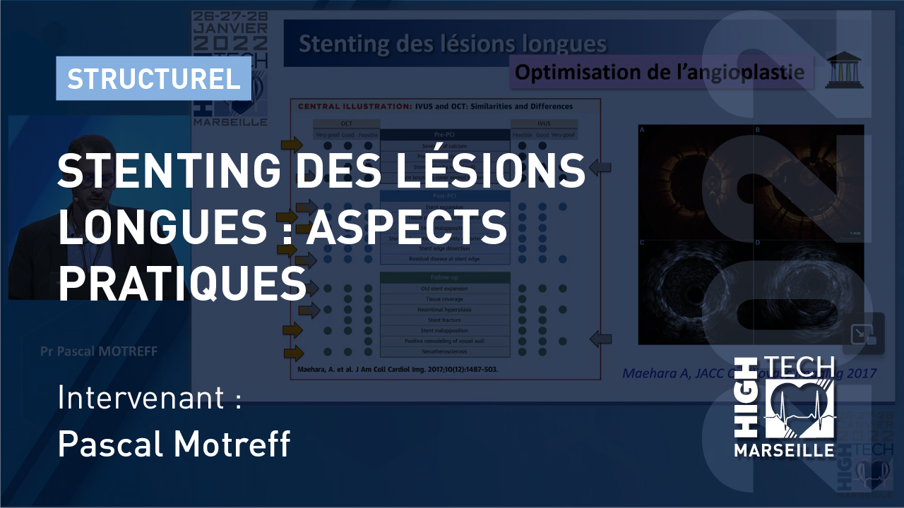 Stenting des lésions longues : aspects pratiques – Pascal Motreff