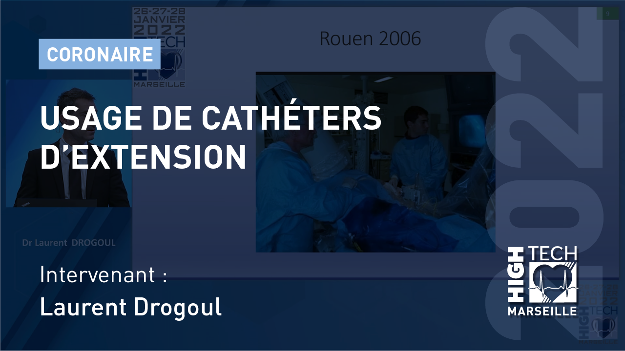 Usage de cathéters d’extension – Laurent Drogoul