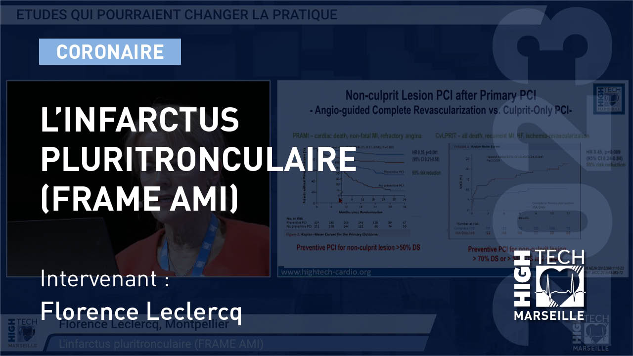L’infarctus pluritronculaire (FRAME AMI) – Florence Leclercq