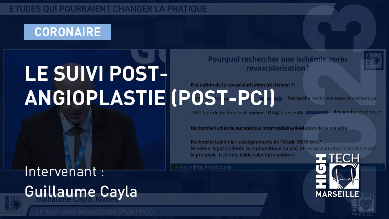 Le suivi post-angioplastie (POST-PCI) – Guillaume Cayla