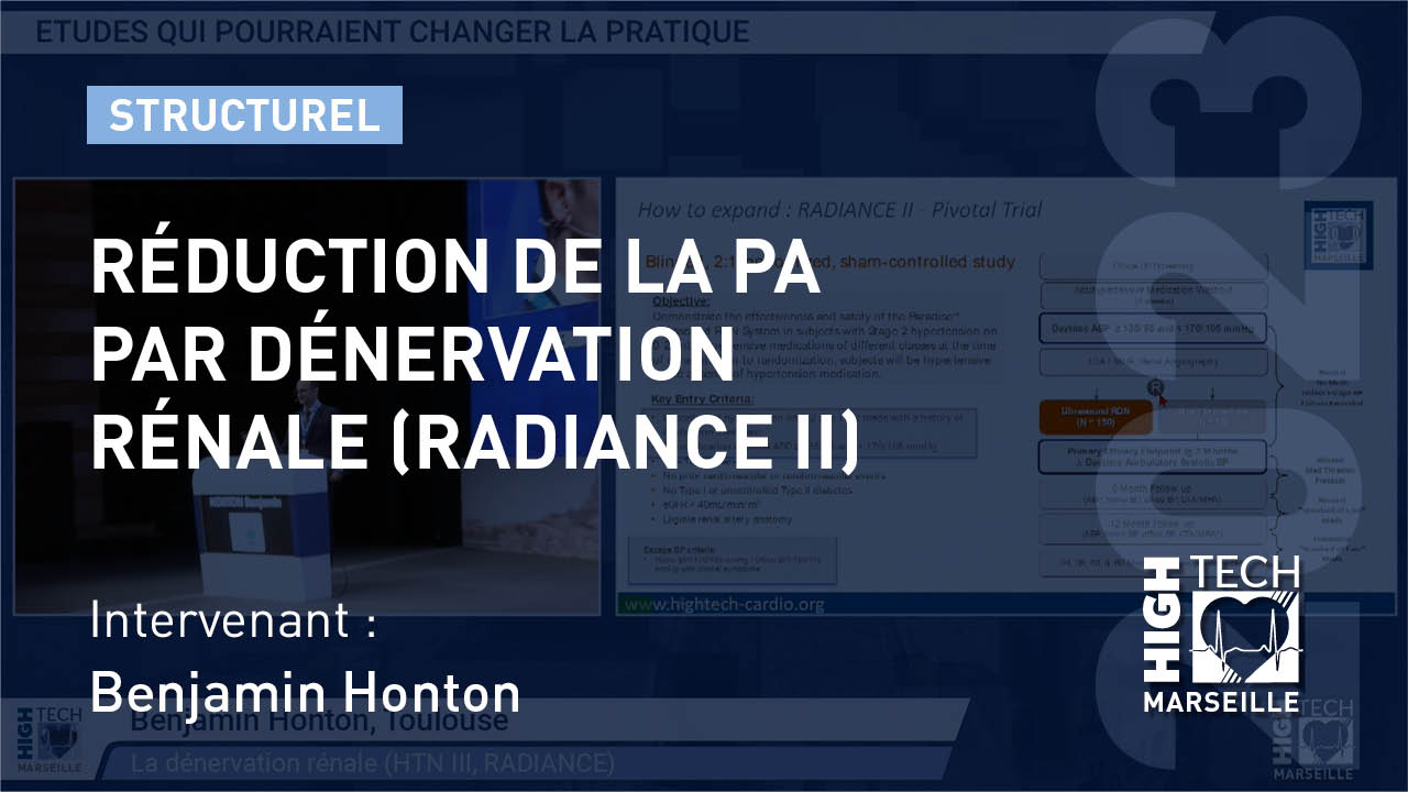 Réduction de la PA par dénervation rénale (RADIANCE II)  – Benjamin Honton