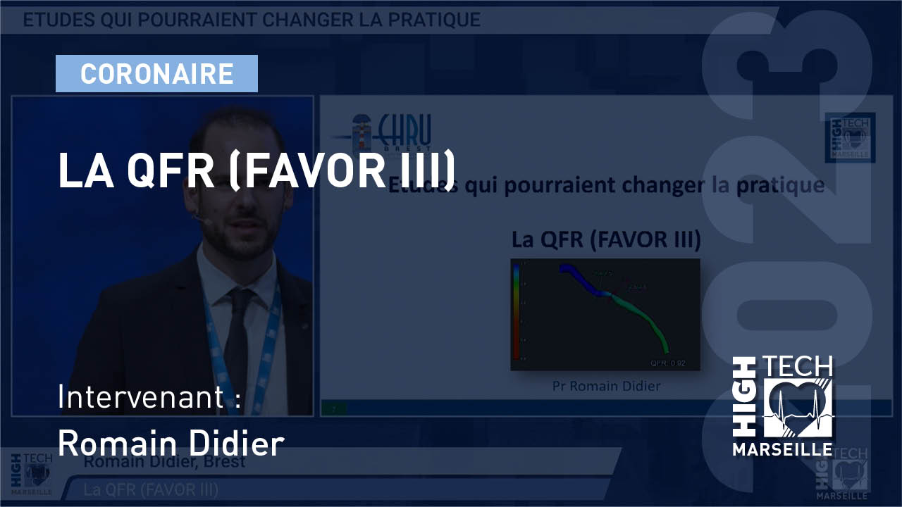 La QFR (FAVOR III) – Romain Didier