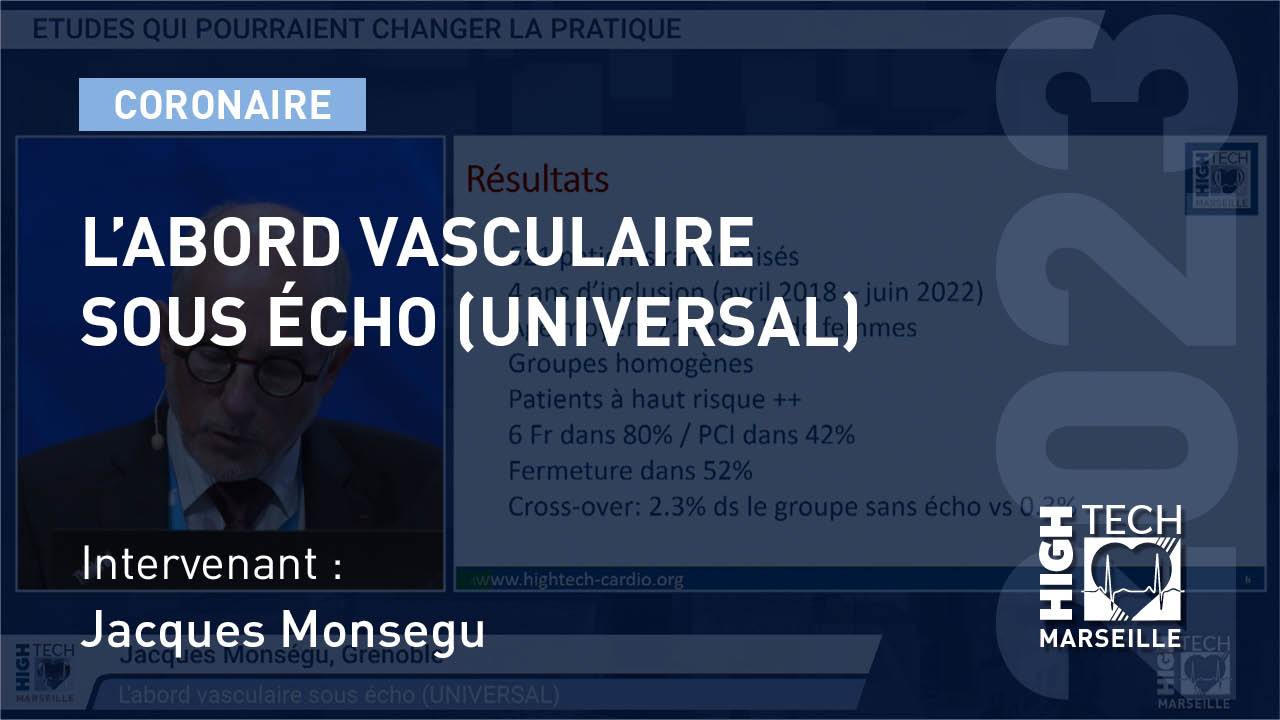 L’abord vasculaire sous écho (UNIVERSAL)- Jacques Monsegu
