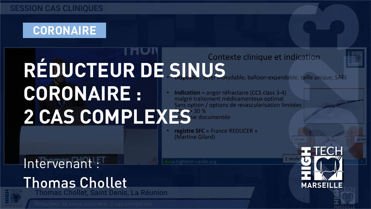 Réducteur de sinus coronaire: 2 cas complexes – Thomas Chollet