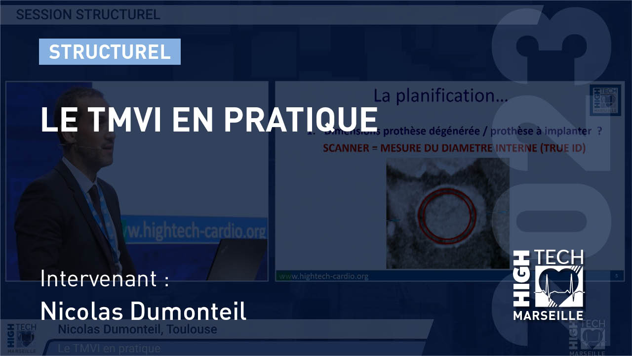 Le TMVI en pratique – Nicolas Dumonteil