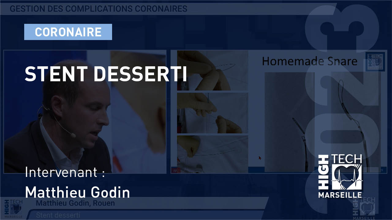 Stent desserti – Matthieu Godin