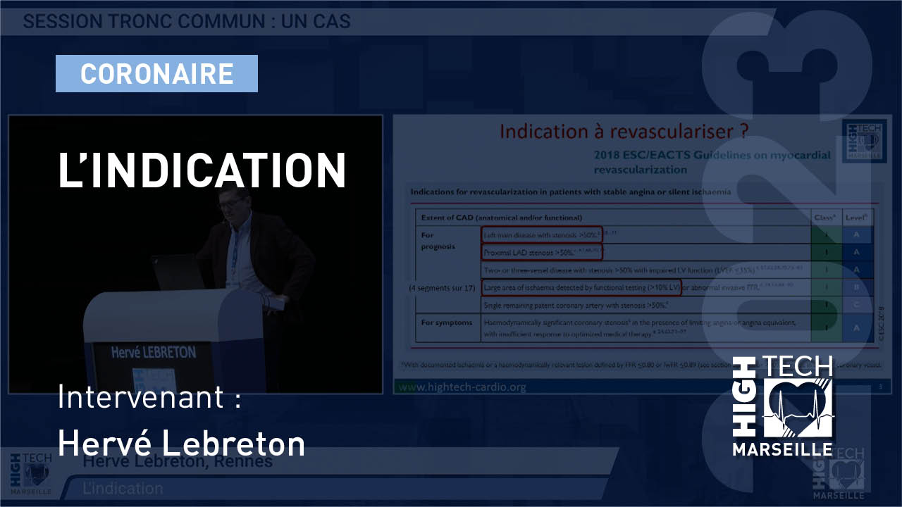 L’indication –  Hervé Lebreton