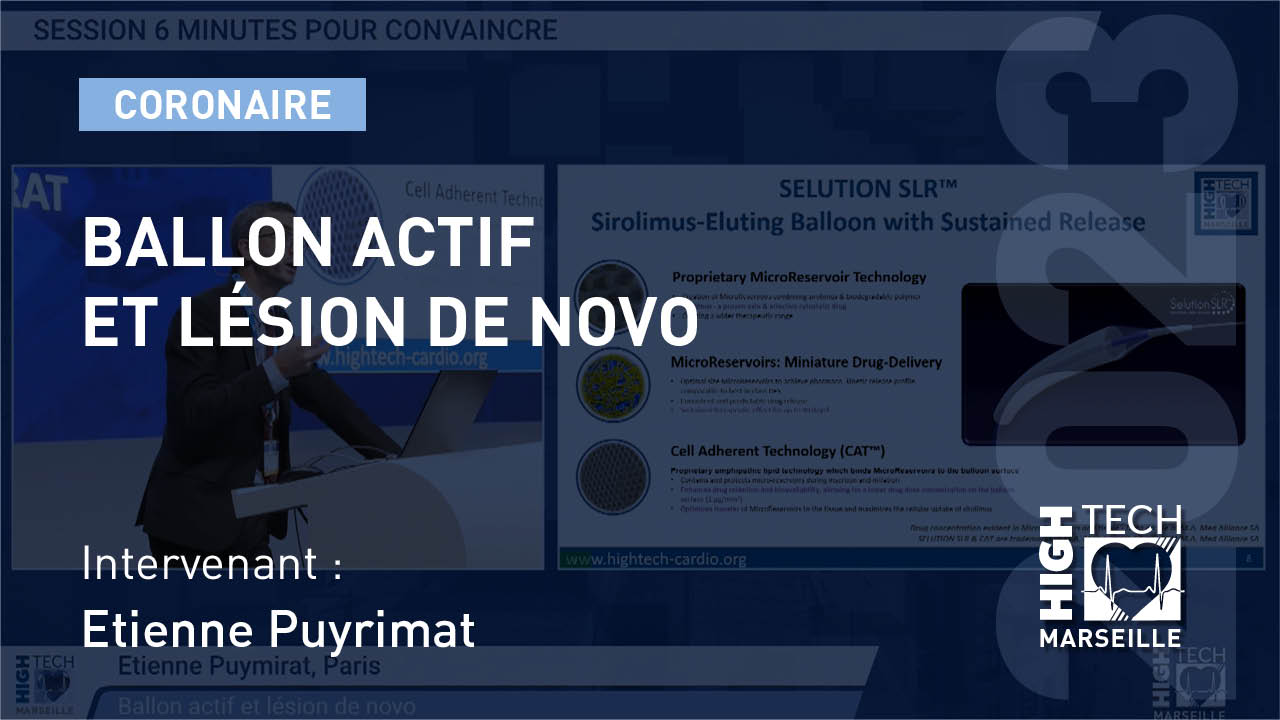 Ballon actif et lésion de novo – Étienne Puyrimat