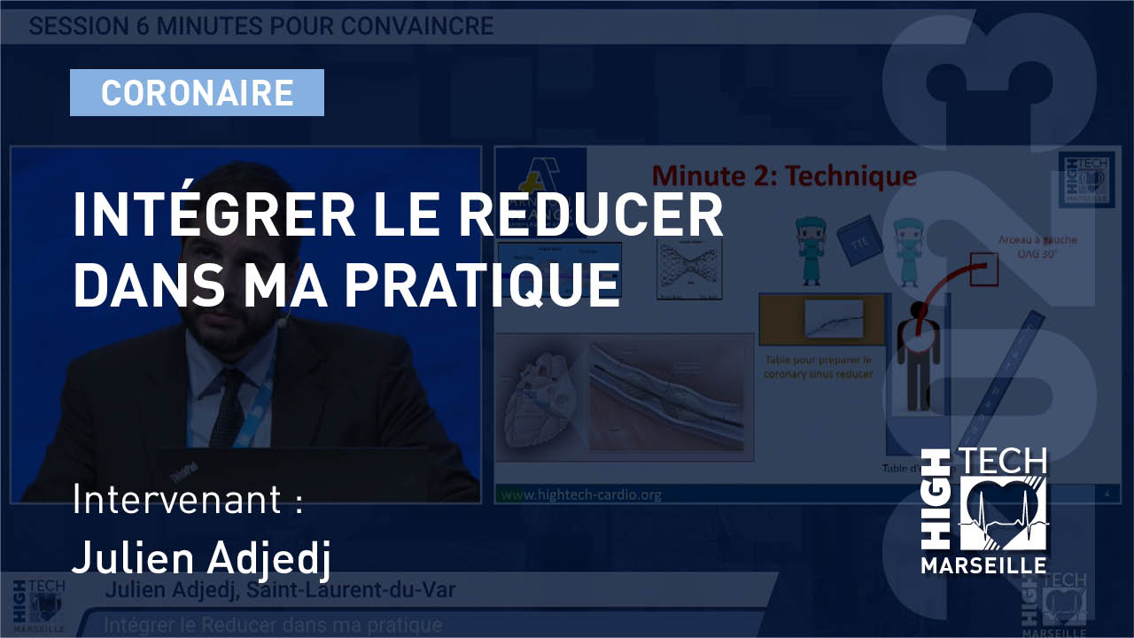 Intégrer le Reducer dans ma pratique – Julien Adjedj