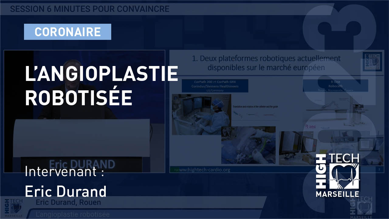 L’angioplastie robotisée – Éric Durand