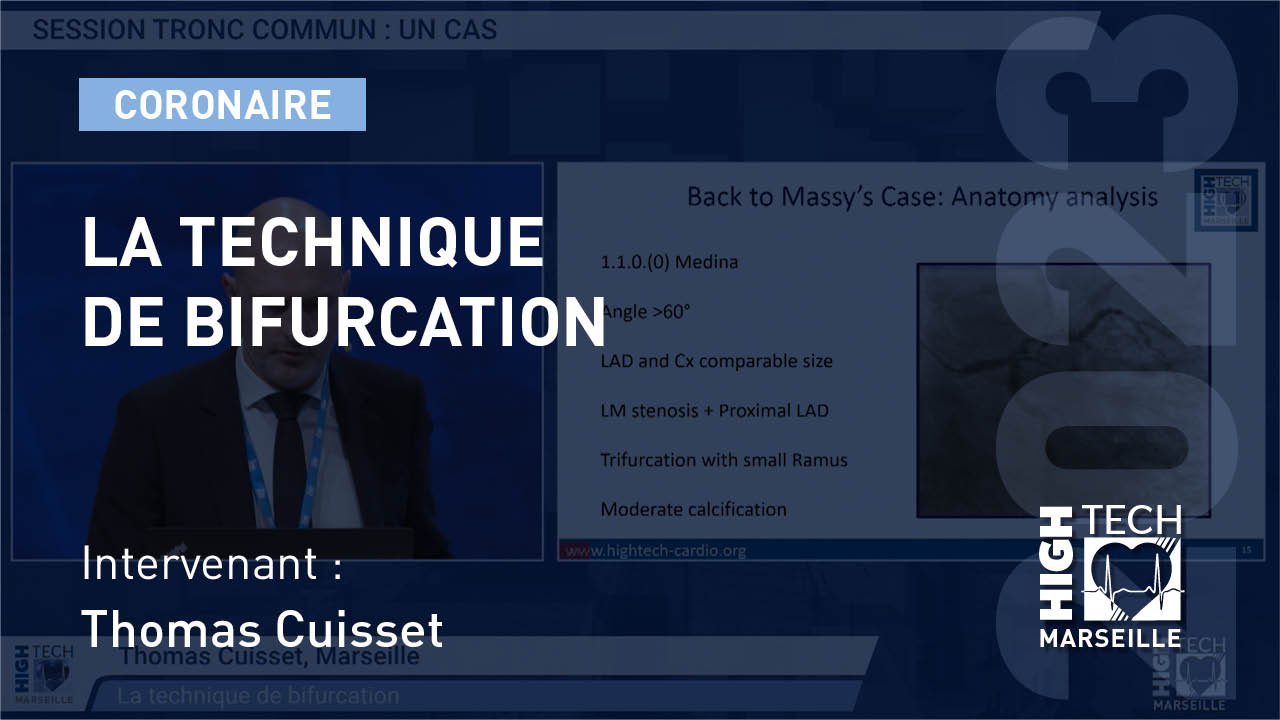 La technique de bifurcation –  Thomas Cuisset