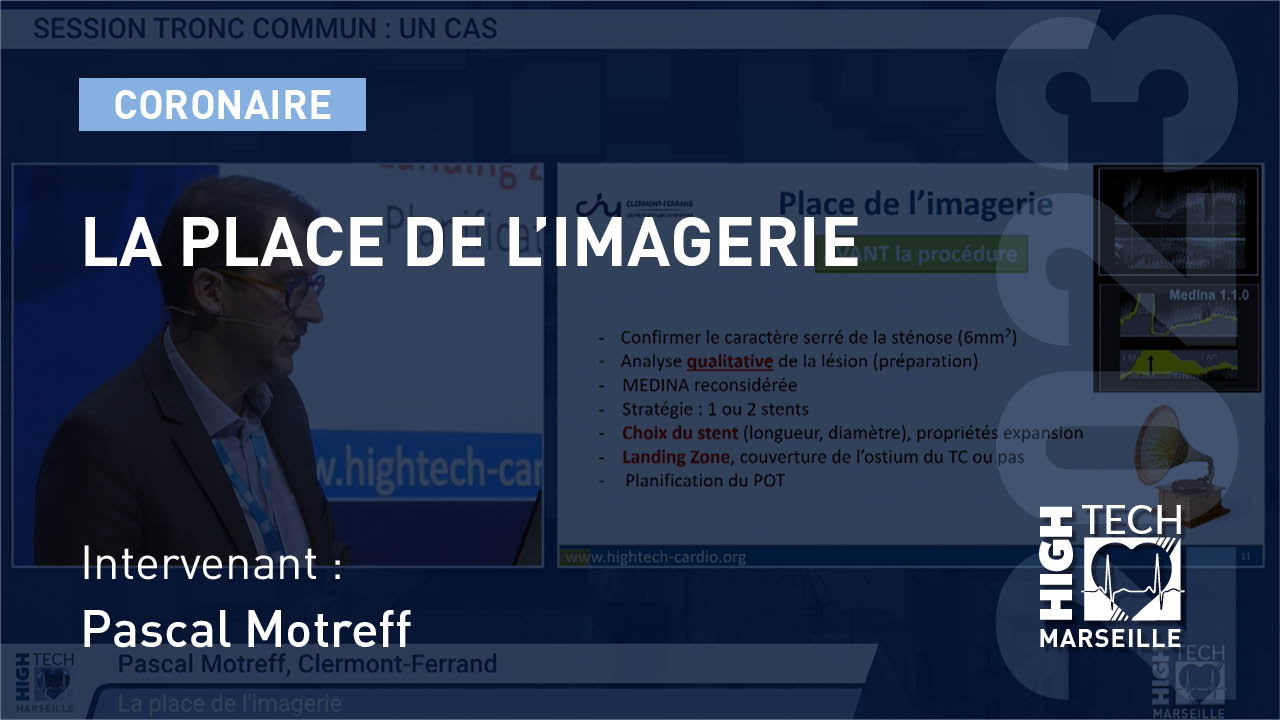 La place de l’imagerie – Pascal Motreff