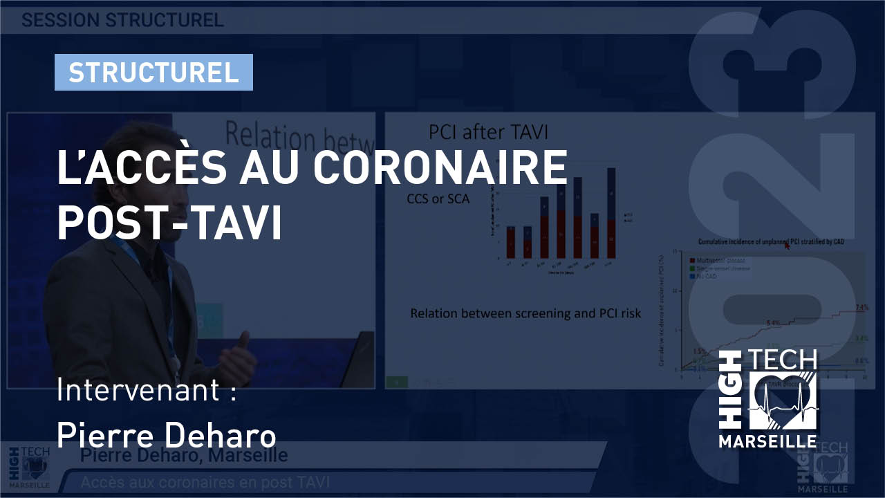 L’accès au coronaire post-TAVI – Pierre Deharo